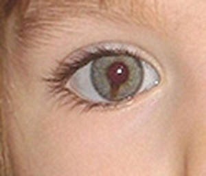 eye.jpg